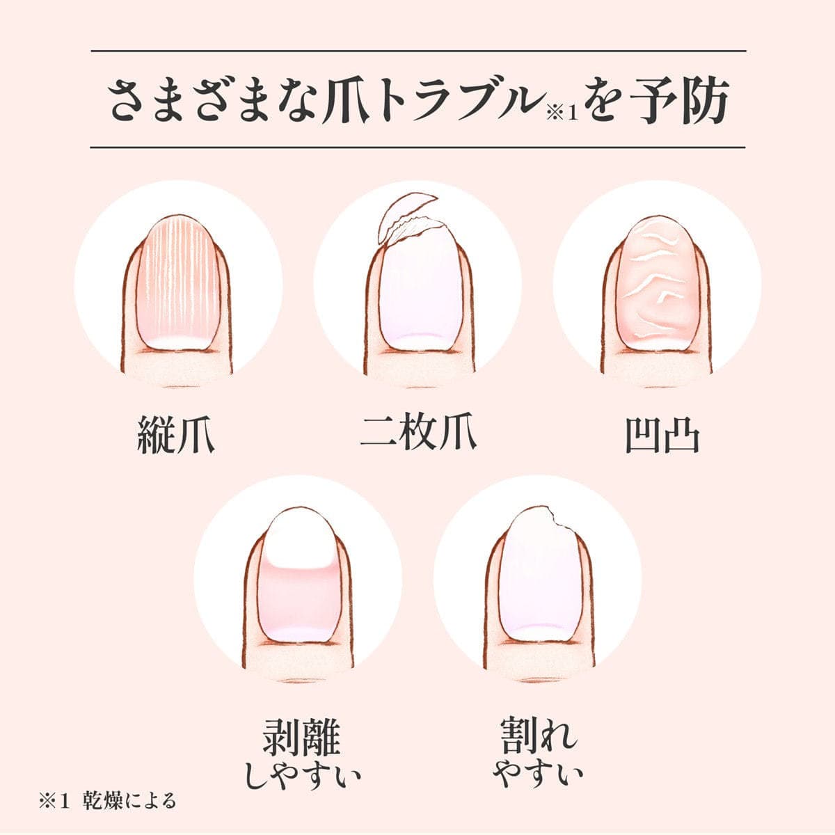 m.Soin ダメージネイルセラム 4