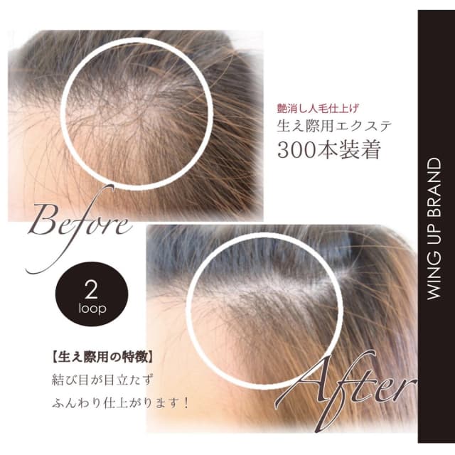 【WING UP】ヘアボリュームアップ生え際用[オリーブ]2本500束1000本 3