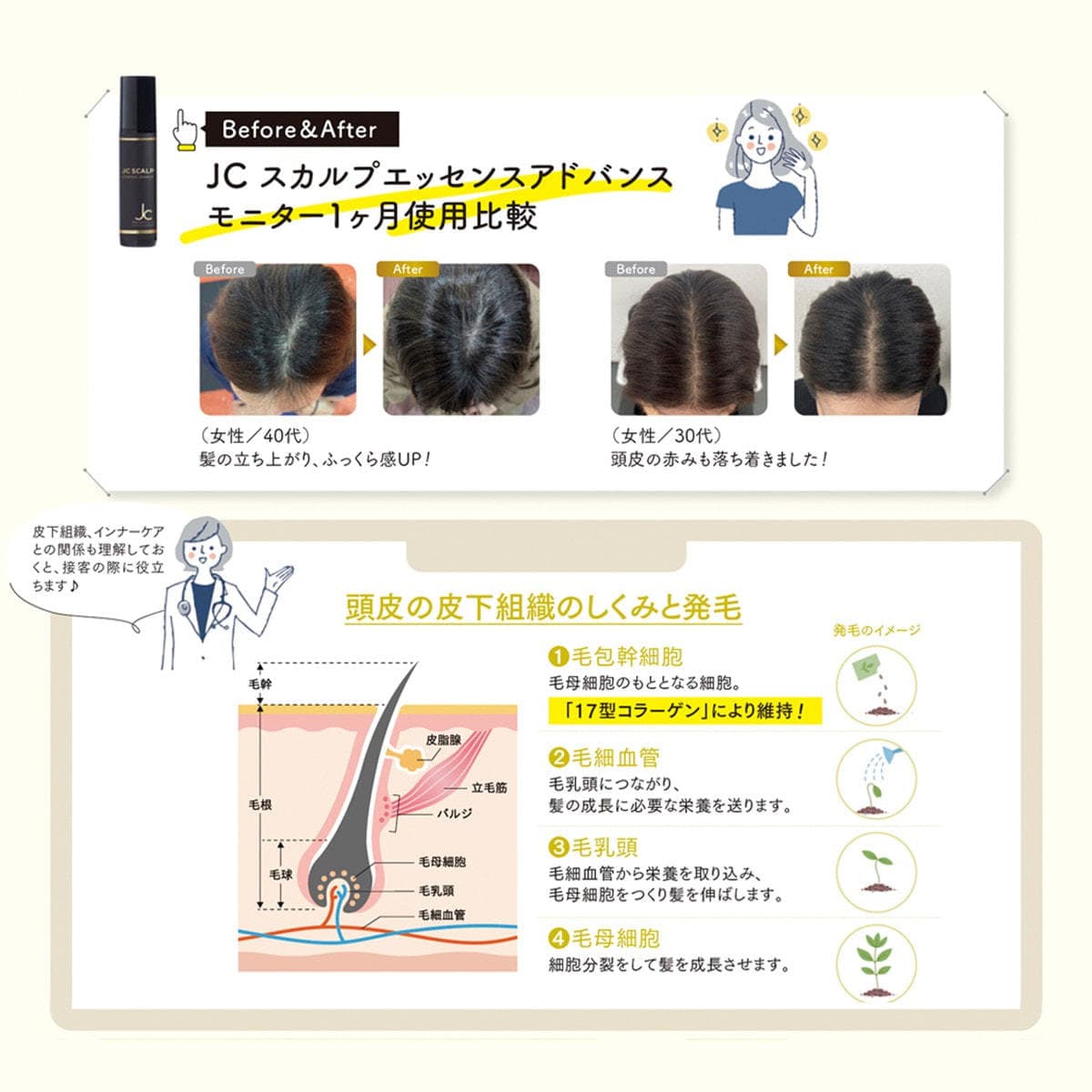 JC スカルプエッセンスアドバンス 100mL 4