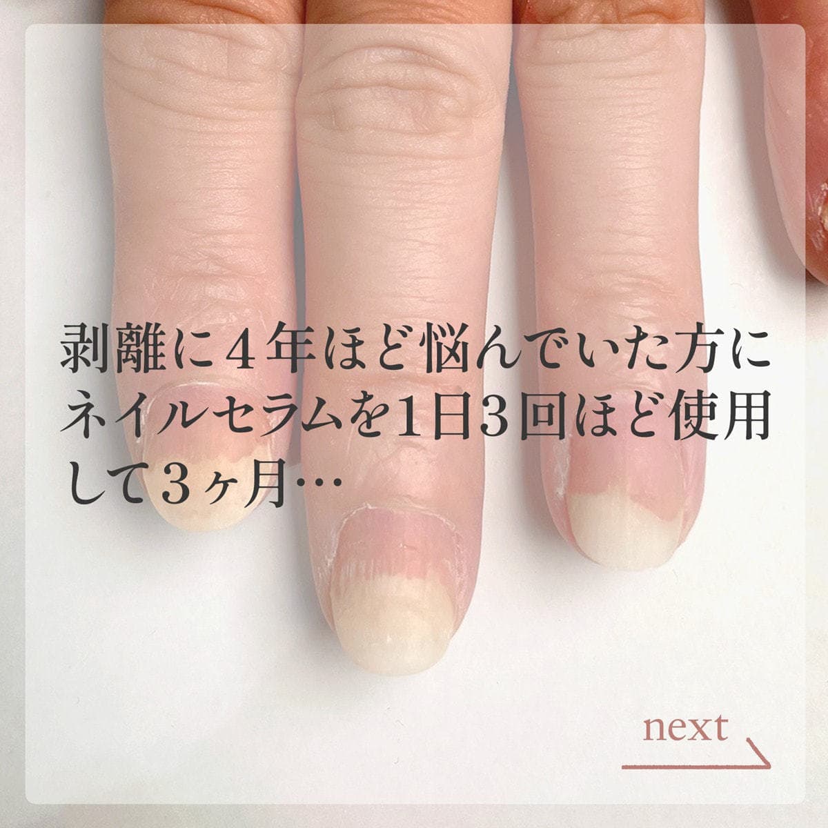 m.Soin ダメージネイルセラム 5
