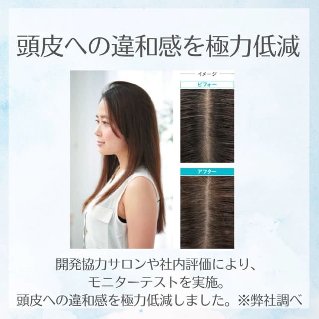 sroloc OX3% (エスロロック 2剤) 2000ml【医薬部外品】 4