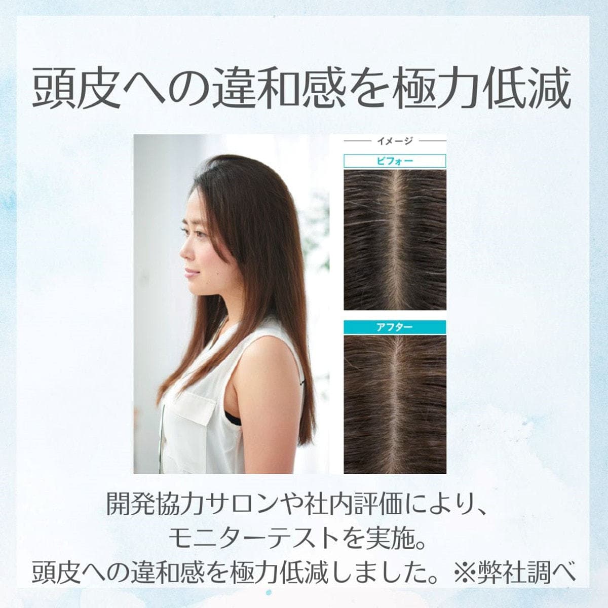sroloc OX3% (エスロロック 2剤) 2000ml【医薬部外品】 4